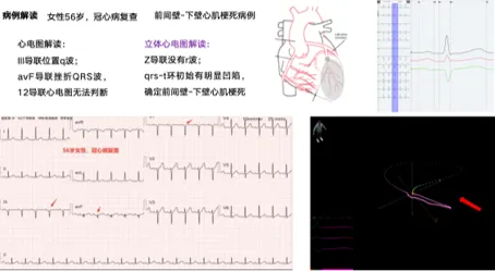 海愿资本数千万首轮独家投资「万卡迪医疗」，助力立体心电等创新技术落地
